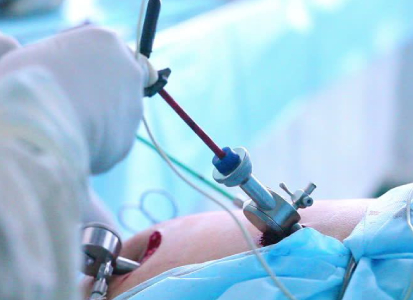 Consultant Advanced Laparoscopic